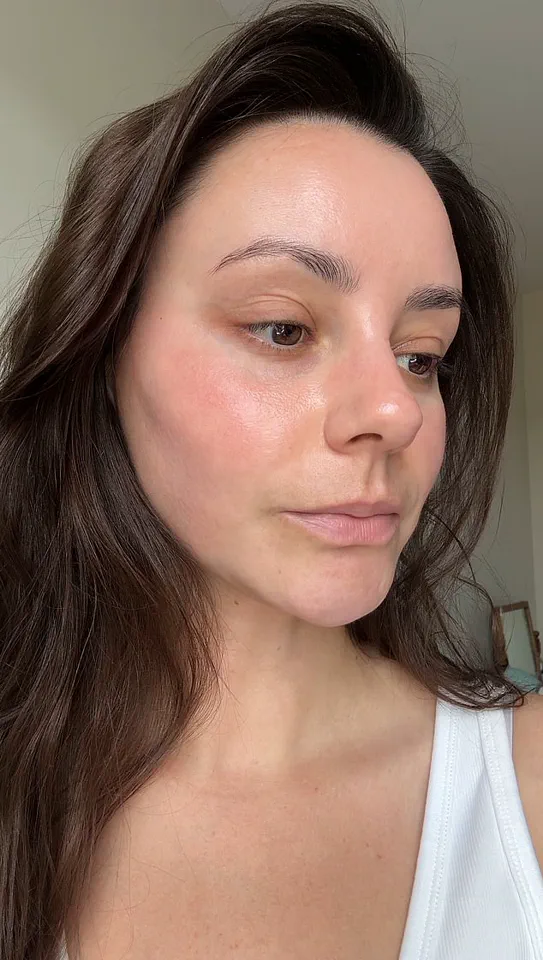 Beauty Editor's Silent Adversary: The Urgent Health Crisis Behind the Glamour