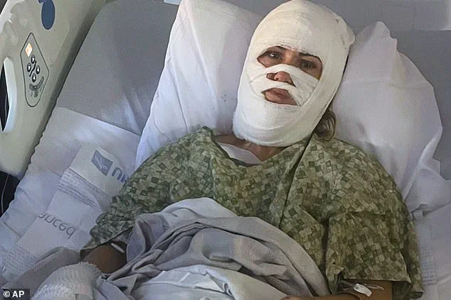 Severe Corrosive Attack in Savannah Park Leaves Woman with Extensive Burns, Highlighting Community Safety Risks
