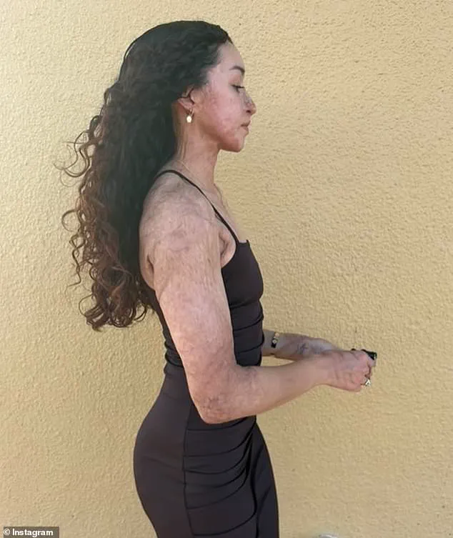 Davina Licon Survives Shooting Near Planet Fitness Days Before First Bodybuilding Competition