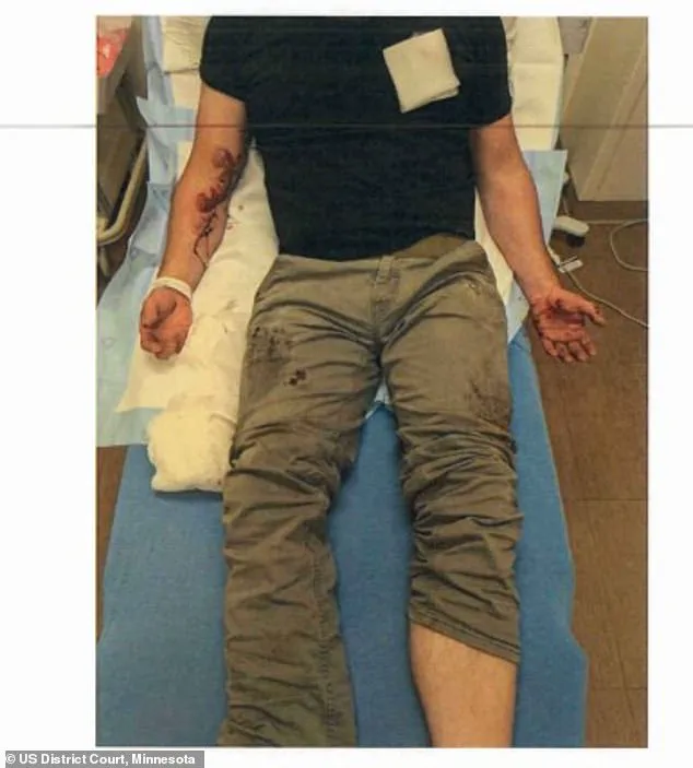 Clashing Accounts and Injuries: The Aftermath of the Anti-ICE Protest in Minneapolis, Michigan