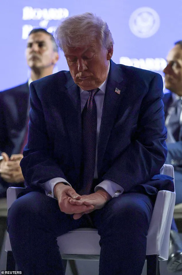 President Trump Reveals Bruise Sustained During Davos Event, Calls It a Simple Mishap