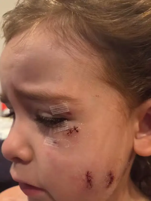 Two Canadian Mothers and Child Fight for Lives After Brutal Dog Attack in Oshawa
