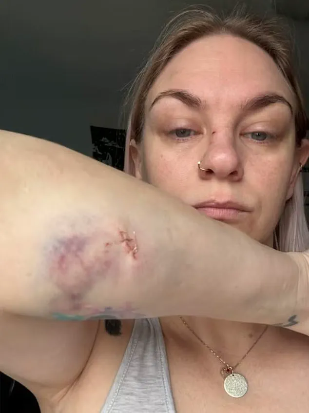 Two Canadian Mothers and Child Fight for Lives After Brutal Dog Attack in Oshawa
