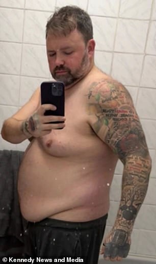 Man Warns After Losing Weight on Mounjaro Then Dying of Gallbladder Infection